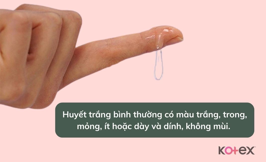 Huyết trắng là gì?