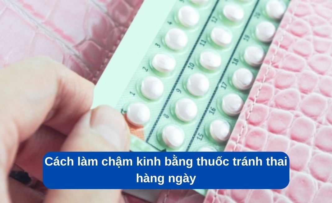 Cách làm chậm kinh bằng thuốc tránh thai