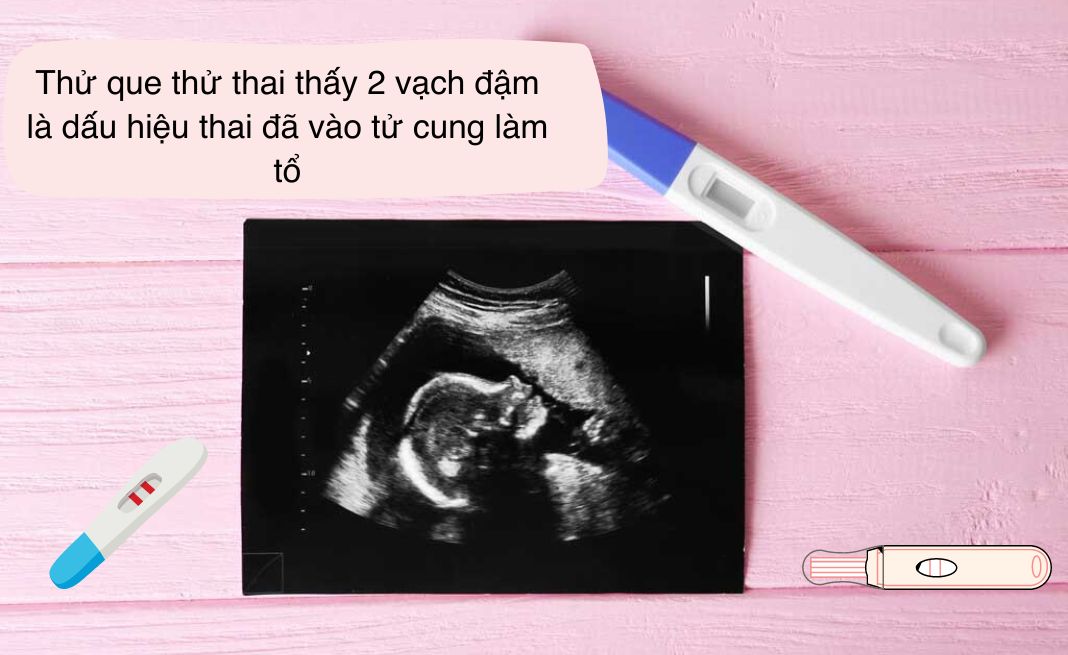 Thử que thử thai thấy 2 vạch đậm là dấu hiệu thai đã vào tử cung làm tổ