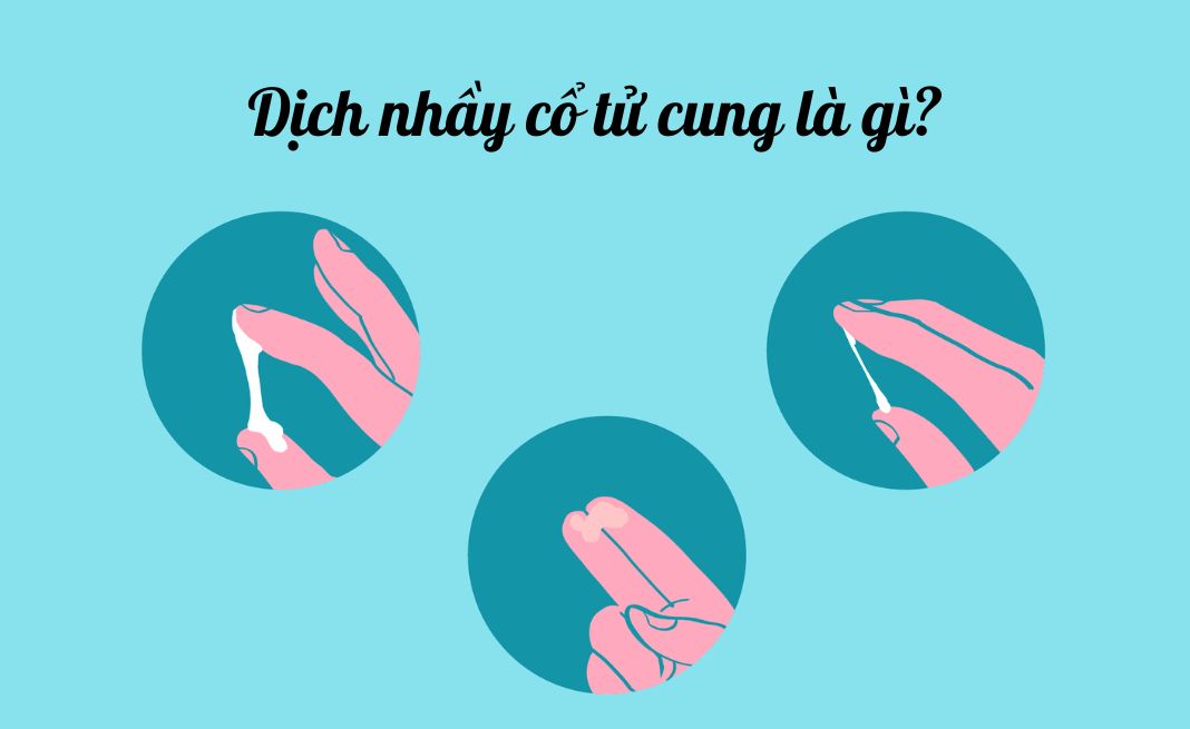 Dịch nhầy cổ tử cung là cơ chế tự động bảo vệ tử cung