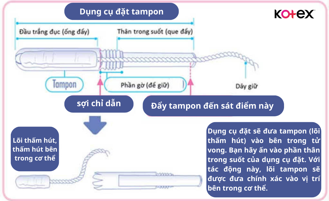 Cấu tạo chi tiết của tampon