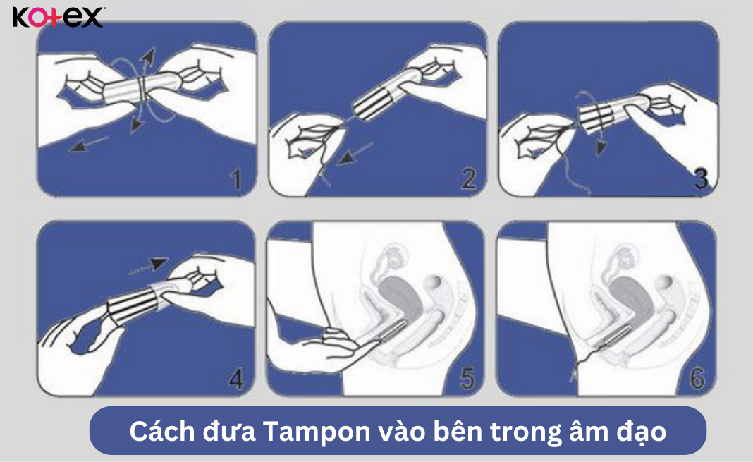 Dùng tampon đi biển giúp thoải mái, không bị tràn kinh