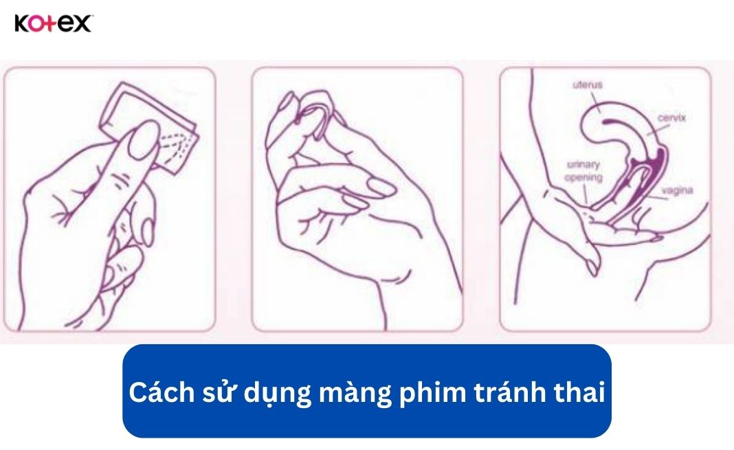 Cách sử dụng màng phim tránh thai