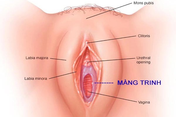 Màng trinh là một màng mỏng nằm trong âm đạo, cách cửa âm đạo khoảng 2-3 cm