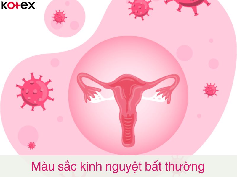 Màu sắc kinh nguyệt tiềm ẩn nguy cơ nhiễm trùng hoặc bệnh lý bị lây lan qua đường tình dục.