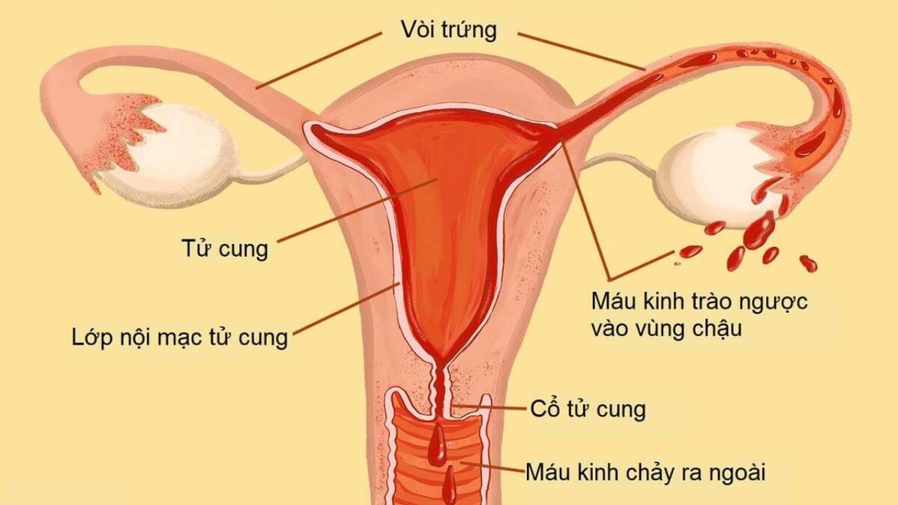 Khi trứng không được thụ tinh, hoàng thể bị thoái hóa. Dưới sự co bóp của tử cung, lớp niêm mạc sẽ bong ra ngoài kèm theo máu