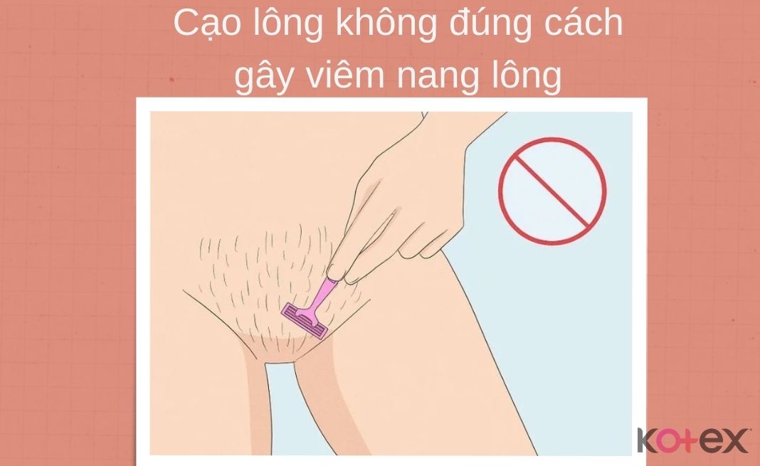 Cạo lông không đúng cách gây viêm nang lông, nổi mụn ở vùng kín