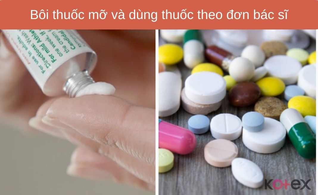 Bôi thuốc mỡ và dùng thuốc theo đơn bác sĩ