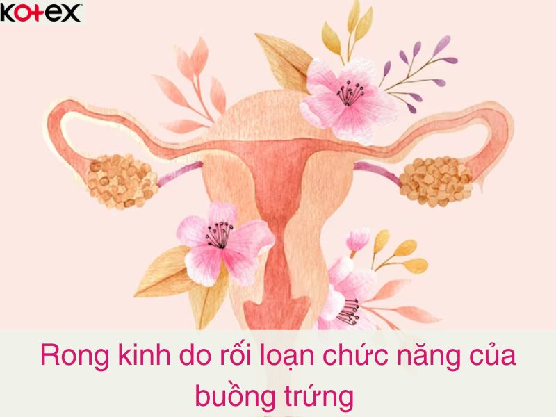 Rong kinh do rối loạn chức năng của buồng trứng