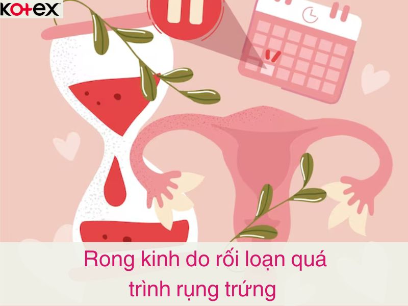 Rong kinh do rối loạn quá trình rụng trứng