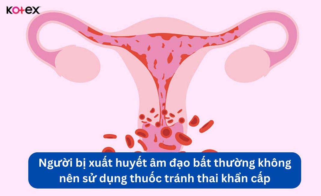 Xuất huyết âm đạo bất thường là đối tượng không nên sử dụng thuốc tránh thai khẩn cấp