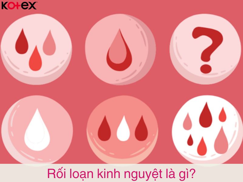 Rối loạn kinh nguyệt là gì