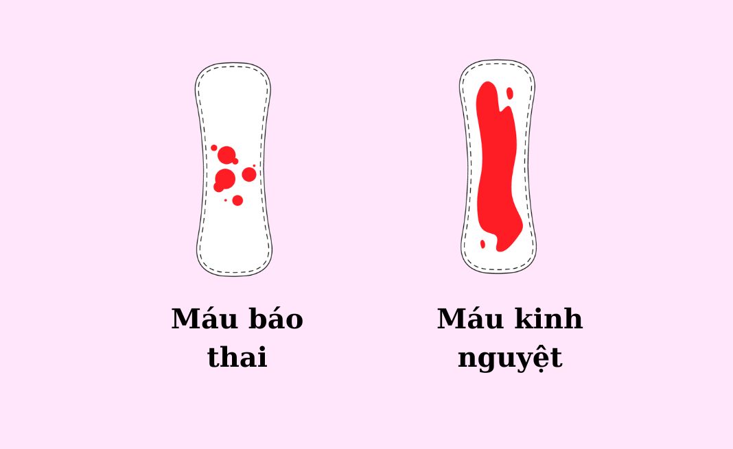 Đặc điểm của máu báo thai